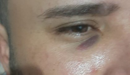 Empresário afirma ter sido agredido por jogador durante festa. (Foto: Arquivo Pessoal)