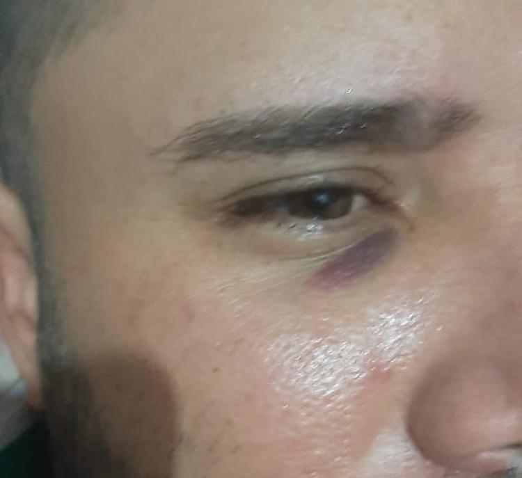Empresário afirma ter sido agredido por jogador durante festa.