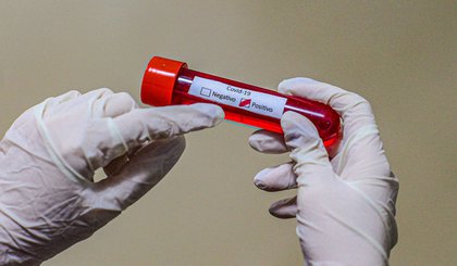coronavirus (Foto: Eduardo Valente/FramePhoto/Folhapress)