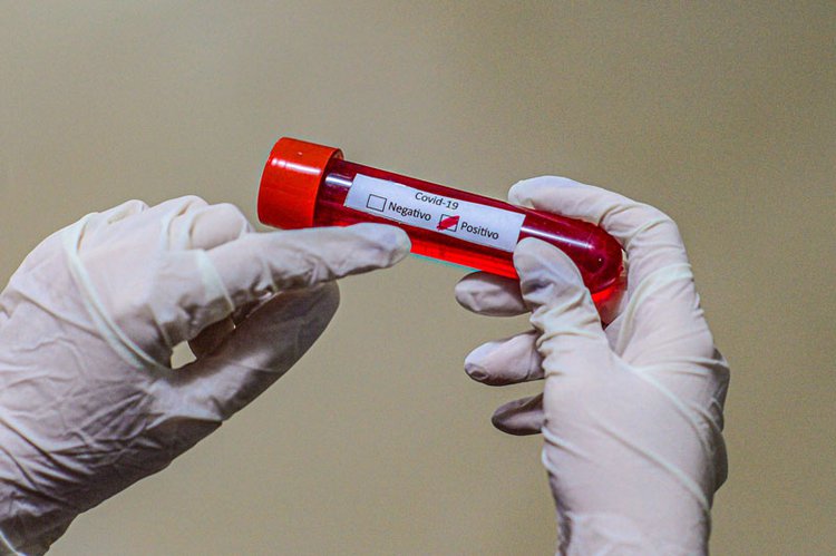 coronavirus