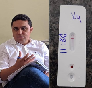 James Rodrigues testa positivo para Covid-19.