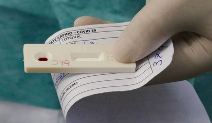 Covid está em queda de 21% no número de casos no Piauí. (Foto: Reprodução)