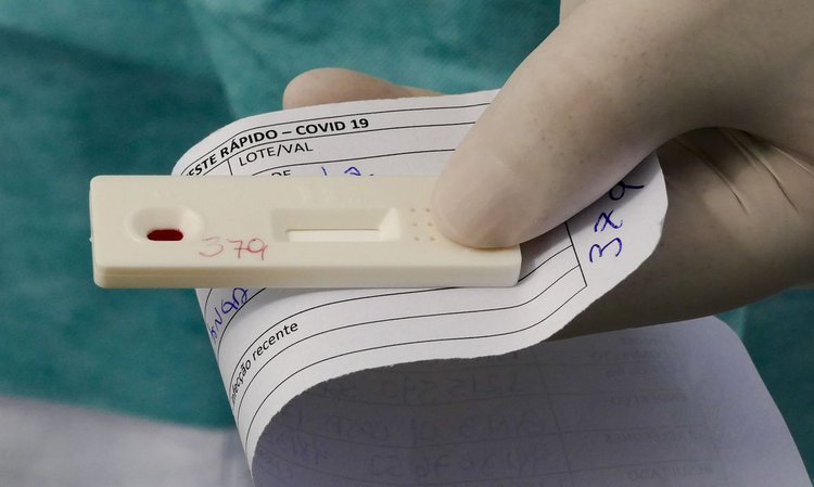 Covid está em queda de 21% no número de casos no Piauí.
