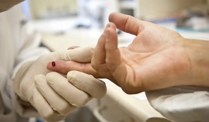 exame ists aids (Foto: Arquivo/ Agência Brasil)