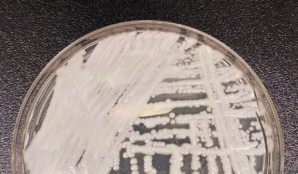 São Paulo confirma primeiro caso de superfungo Candida auris. (Foto: CDC/DR. LEANOR HAILEY)
