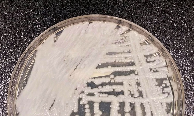 São Paulo confirma primeiro caso de superfungo Candida auris.
