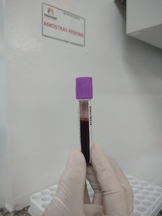 O transplante é, em algumas situações, a única ou principal chance de cura para esses pacientes.