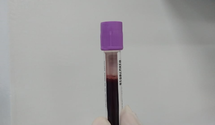 O transplante é, em algumas situações, a única ou principal chance de cura para esses pacientes. (Foto: Reprodução)
