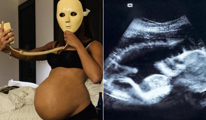 Anitta exibe barrigão de grávida e ultrassom (Foto: Reprodução / Redes Sociais) Anitta exibe barrigão de grávida e ultrassom (Foto: Reprodução / Redes Sociais)