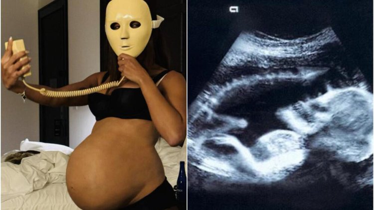 Anitta exibe barrigão de grávida e ultrassom