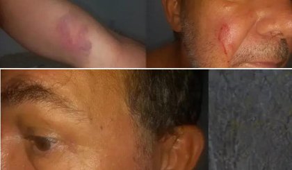 Polícia investiga agressão e roubo contra jornalista (Foto: Reprodução) Polícia investiga agressão e roubo contra jornalista (Foto: Reprodução)