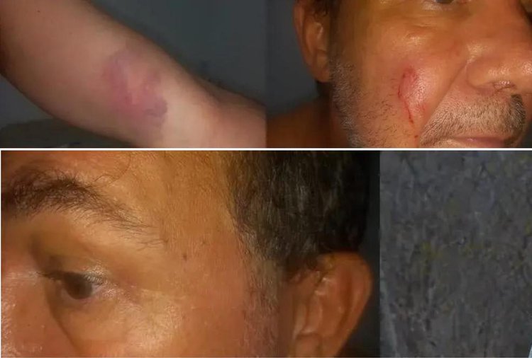 Polícia investiga agressão e roubo contra jornalista