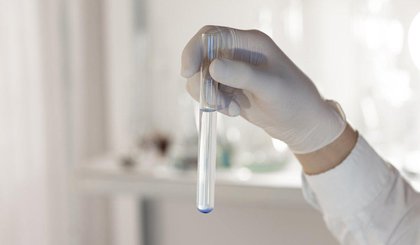 Teste capaz de antecipar em até 10 anos o HPV deve ser implantado no SUS (Foto: Freepik) Teste capaz de antecipar em até 10 anos o HPV deve ser implantado no SUS (Foto: Freepik)