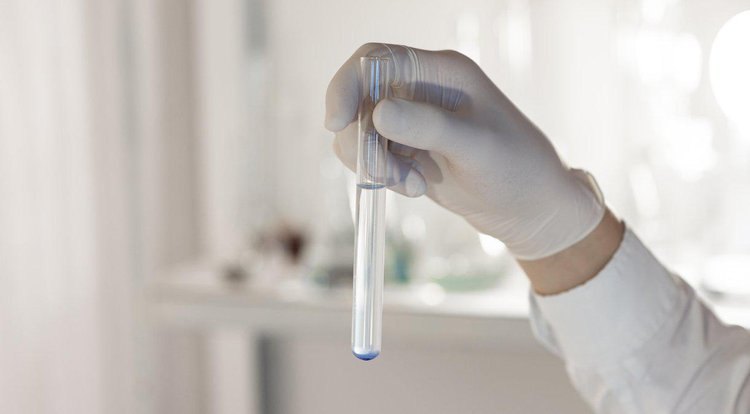 Teste capaz de antecipar em até 10 anos o HPV deve ser implantado no SUS