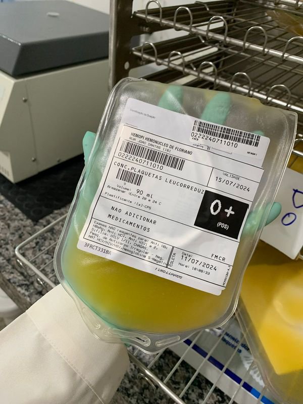 Hemopi inicia produção e distribuição de plaquetas em Floriano e descentraliza serviço