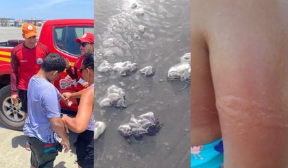 Mais de 40 pessoas foram vítimas de queimaduras pelas águas-vivas (Foto: Corpo de Bombeiros Militar do Estado do Piauí)