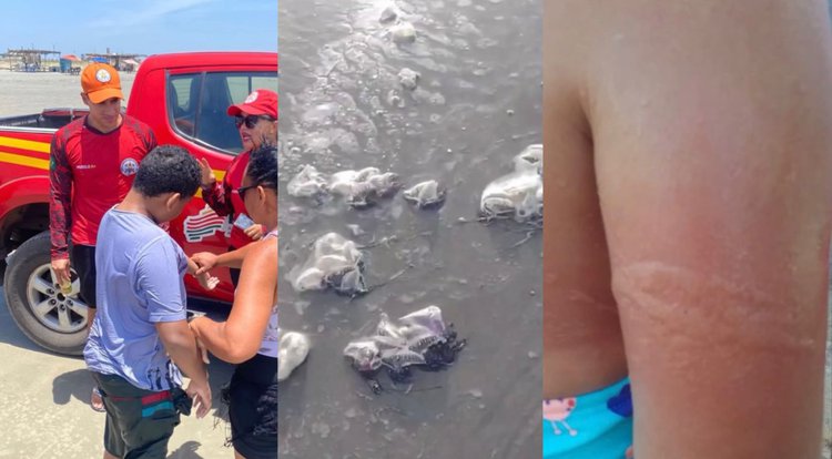 Mais de 40 pessoas foram vítimas de queimaduras pelas águas-vivas