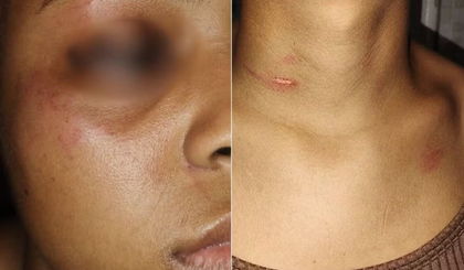 Mulher é agredida por esposa de cliente. (Foto: Arquivo Pessoal)