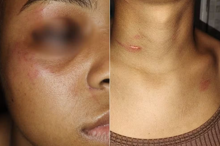 Mulher é agredida por esposa de cliente.