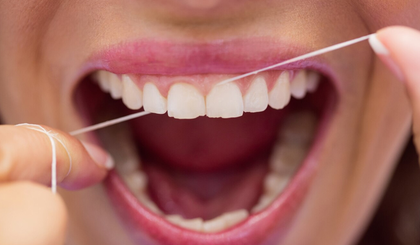 Uso semanal de fio dental pode reduzir riscos de AVC e arritmia. (Foto: Reprodução) Uso semanal de fio dental pode reduzir riscos de AVC e arritmia. (Foto: Reprodução)