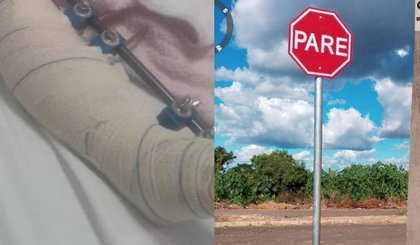 Criança é atropelada em Teresina e motorista foge sem prestar socorro. (Foto: Reprodução) Criança é atropelada em Teresina e motorista foge sem prestar socorro. (Foto: Reprodução)