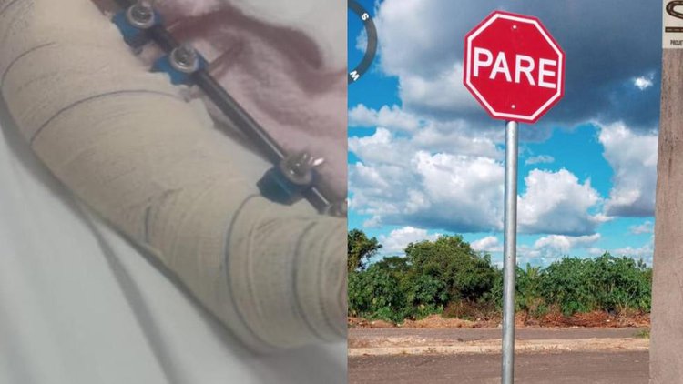 Criança é atropelada em Teresina e motorista foge sem prestar socorro.