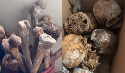 Mais de 12 crânios foram localizados em endereço na zona oeste de SP; perícia analisa o caso (Foto: Reprodução) Mais de 12 crânios foram localizados em endereço na zona oeste de SP; perícia analisa o caso (Foto: Reprodução)