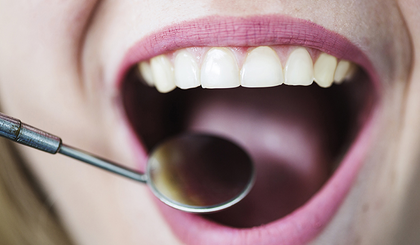 Alergias ligadas à nova fórmula da Colgate Total geram preocupação e relatos. (Foto: Reprodução) Alergias ligadas à nova fórmula da Colgate Total geram preocupação e relatos. (Foto: Reprodução)
