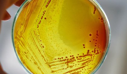 Cultura de laboratório da bactéria Staphylococcus aureus (Foto: Pexels) Cultura de laboratório da bactéria Staphylococcus aureus (Foto: Pexels)