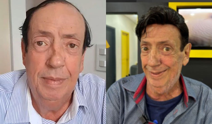 Marcos Oliveira faz implante capilar e ganha casa no Retiro dos Artistas (Foto: Reprodução/redes sociais) Marcos Oliveira faz implante capilar e ganha casa no Retiro dos Artistas (Foto: Reprodução/redes sociais)