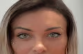 Andressa Urach relata fortes dores após cirurgia para mudar olhos