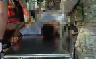 Dois suspeitos de sequestro de adolescente são baleados em confronto com polícia (Foto: Reprodução) Dois suspeitos de sequestro de adolescente são baleados em confronto com polícia (Foto: Reprodução)