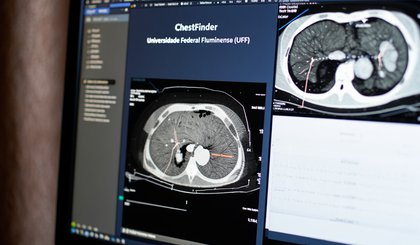 IA promete revolucionar a identificação dessas condições em exames de tomografia computadorizada. (Foto: Gerado por IA) IA promete revolucionar a identificação dessas condições em exames de tomografia computadorizada. (Foto: Gerado por IA)