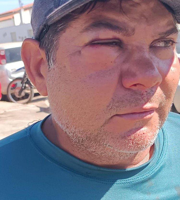 Servidor da prefeitura de São Raimundo Nonato relata ter sido agredido durante cumprimento da função.