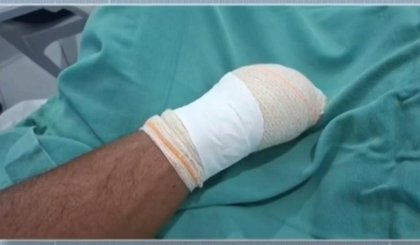 Homem é preso suspeito de decepar mão de vítima com facão após briga por terreno no Piauí (Foto: Reprodução) Homem é preso suspeito de decepar mão de vítima com facão após briga por terreno no Piauí (Foto: Reprodução)