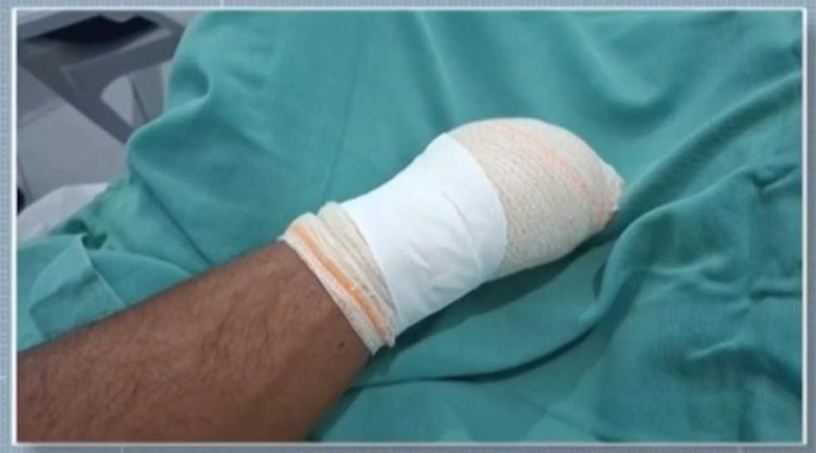Homem é preso suspeito de decepar mão de vítima com facão após briga por terreno no Piauí
