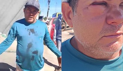 Servidor da prefeitura de São Raimundo Nonato relata ter sido agredido enquanto recolhia vacas na rua (Foto: Reprodução) Servidor da prefeitura de São Raimundo Nonato relata ter sido agredido enquanto recolhia vacas na rua (Foto: Reprodução)