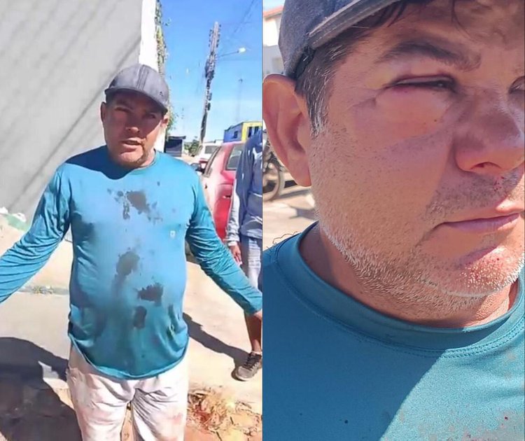 Servidor da prefeitura de São Raimundo Nonato relata ter sido agredido enquanto recolhia vacas na rua