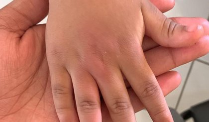 Pais denunciam agressão a criança de cinco anos em escola na zona Leste de Teresina; 'errou uma palavra', diz o pai (Foto: Reprodução) Pais denunciam agressão a criança de cinco anos em escola na zona Leste de Teresina; 'errou uma palavra', diz o pai (Foto: Reprodução)