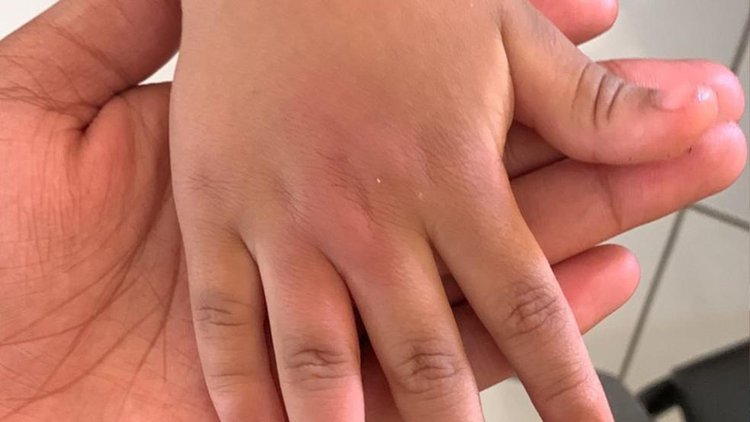 Pais denunciam agressão a criança de cinco anos em escola na zona Leste de Teresina; 'errou uma palavra', diz o pai