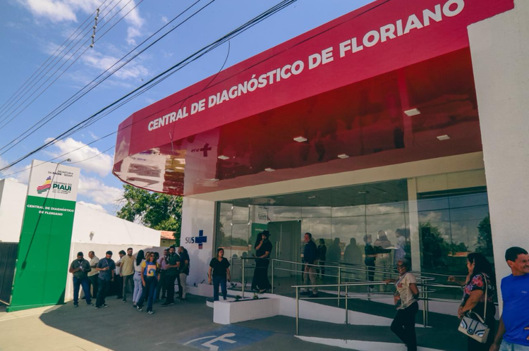 Central de Diagnóstico do Hospital Regional Tibério Nunes ampliará atendimento para até 8 mil exames mensais em Floriano.