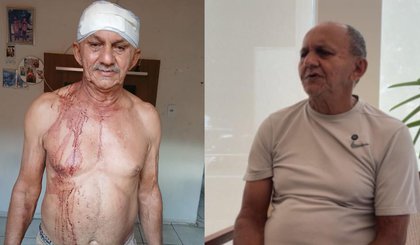 Filho agride pai idoso em Teresina; caso está sob investigação. (Foto: Reprodução / TV Clube) Filho agride pai idoso em Teresina; caso está sob investigação. (Foto: Reprodução / TV Clube)