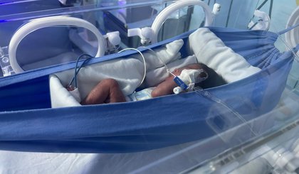 Redinhas trazem mais conforto, estabilidade e bem-estar aos bebês prematuros (Foto: Ascom) Redinhas trazem mais conforto, estabilidade e bem-estar aos bebês prematuros (Foto: Ascom)
