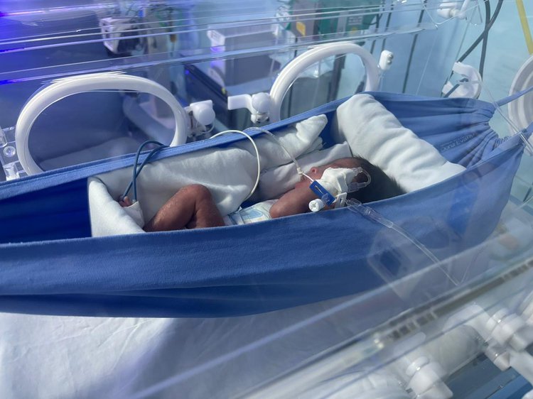 Redinhas trazem mais conforto, estabilidade e bem-estar aos bebês prematuros