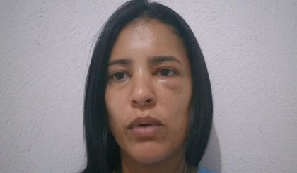 Secretária de Saúde do Piauí relata agressão de ex-namorado. (Foto: TV Clube) Secretária de Saúde do Piauí relata agressão de ex-namorado. (Foto: TV Clube)