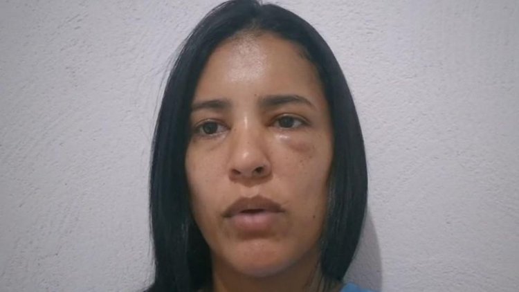 Secretária de Saúde do Piauí relata agressão de ex-namorado.