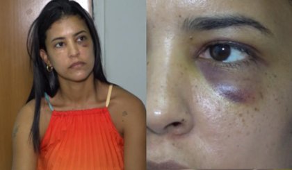 Secretária de Saúde do Piauí relata agressão de ex-namorado	. (Foto: Reprodução / TV Clube)