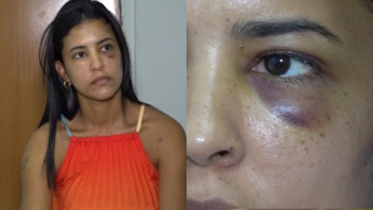 Secretária de Saúde do Piauí relata agressão de ex-namorado	.