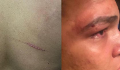 Empresário é confundido e agredido por policiais em Luzilândia. (Foto: Arquivo Pessoal)
