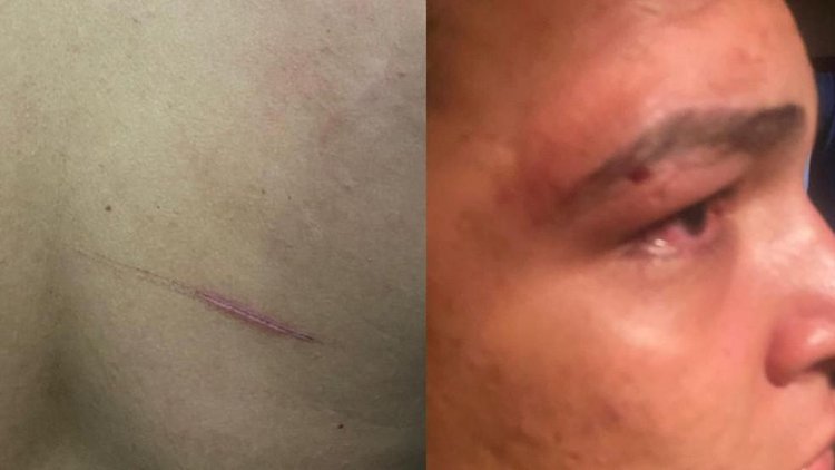 Empresário é confundido e agredido por policiais em Luzilândia.